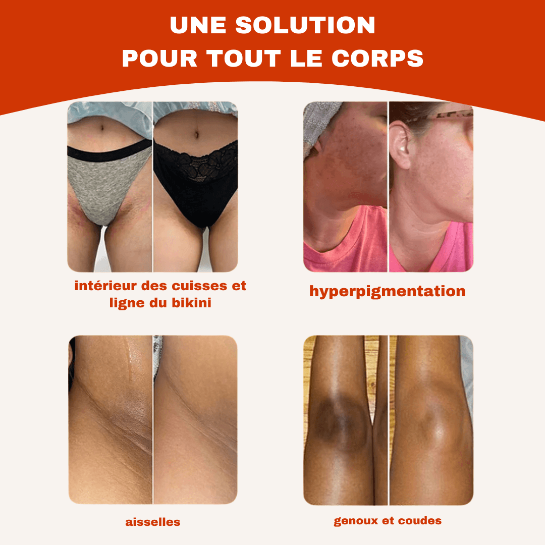 Savon Anti-Taches 100% naturel au Curcuma