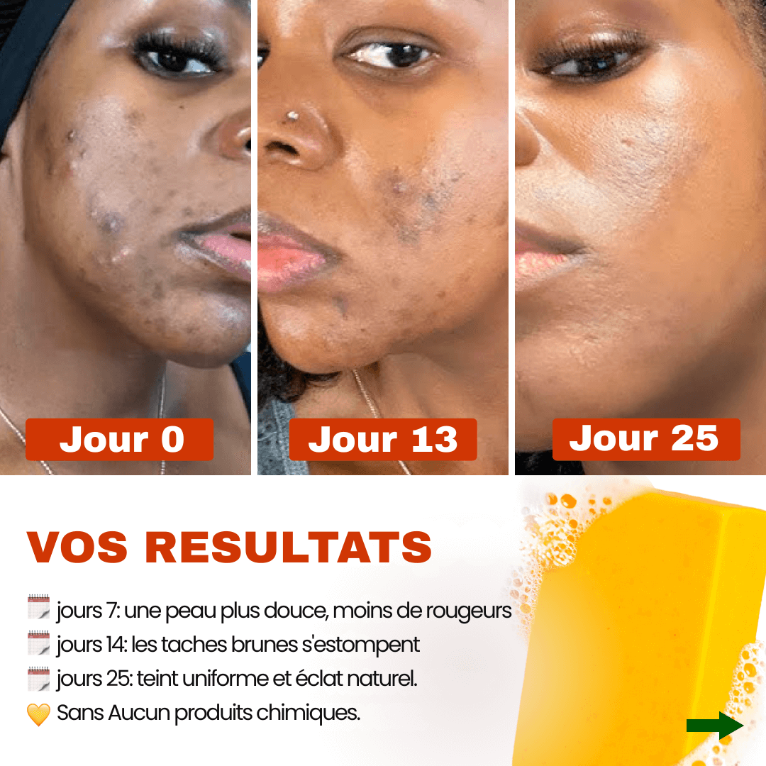Savon Anti-Taches 100% naturel au Curcuma