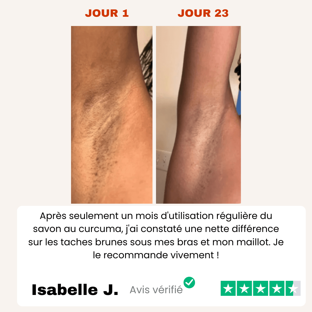 Savon Anti-Taches 100% naturel au Curcuma