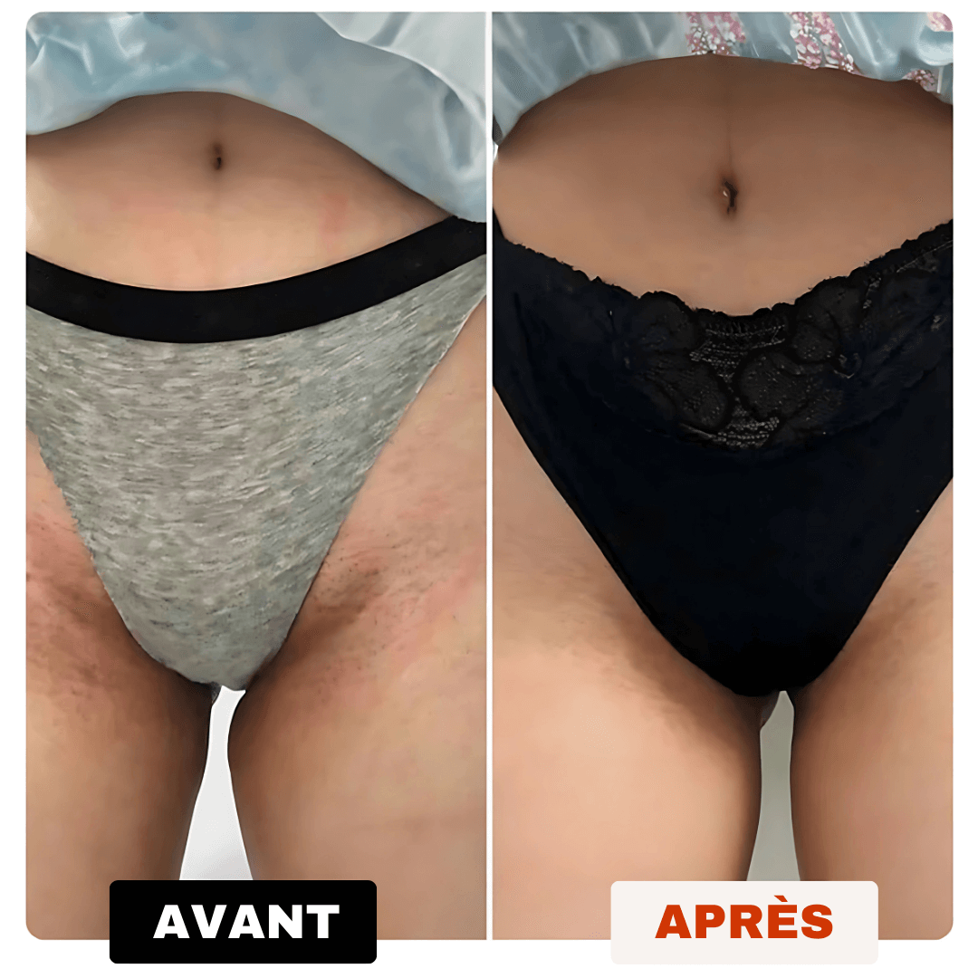 Savon Anti-Taches 100% naturel au Curcuma