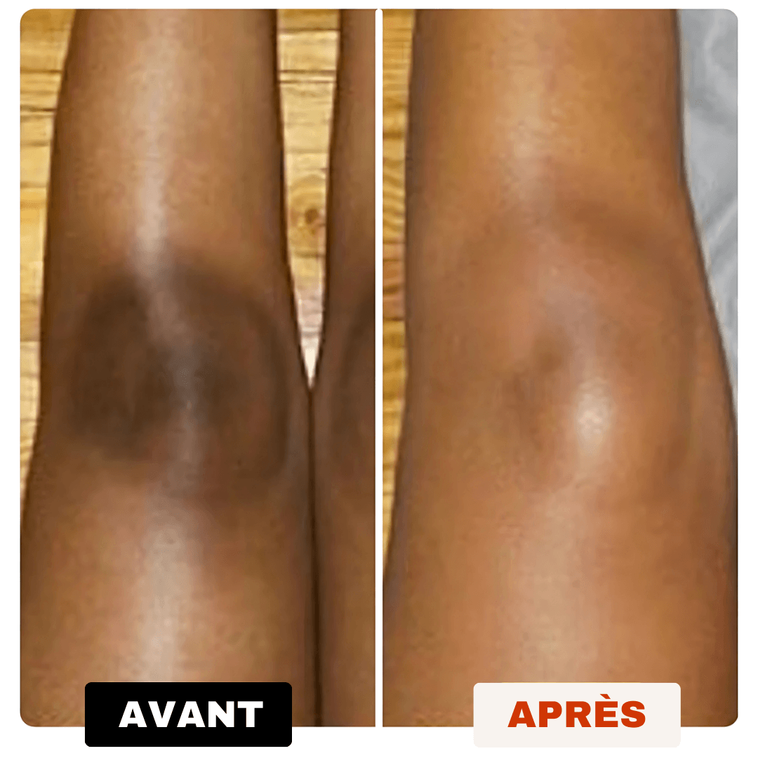 Savon Anti-Taches 100% naturel au Curcuma