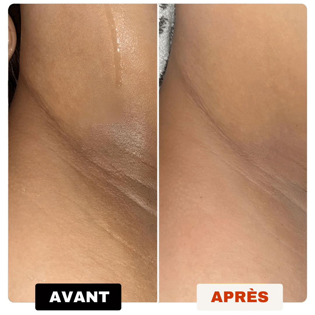 Savon Anti-Taches 100% naturel au Curcuma